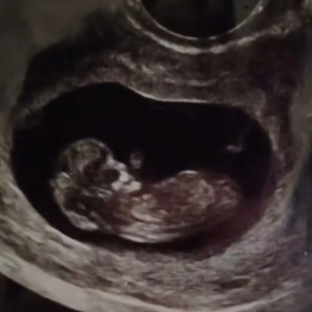Photo shared by Genoveva for their Babylist baby registry.