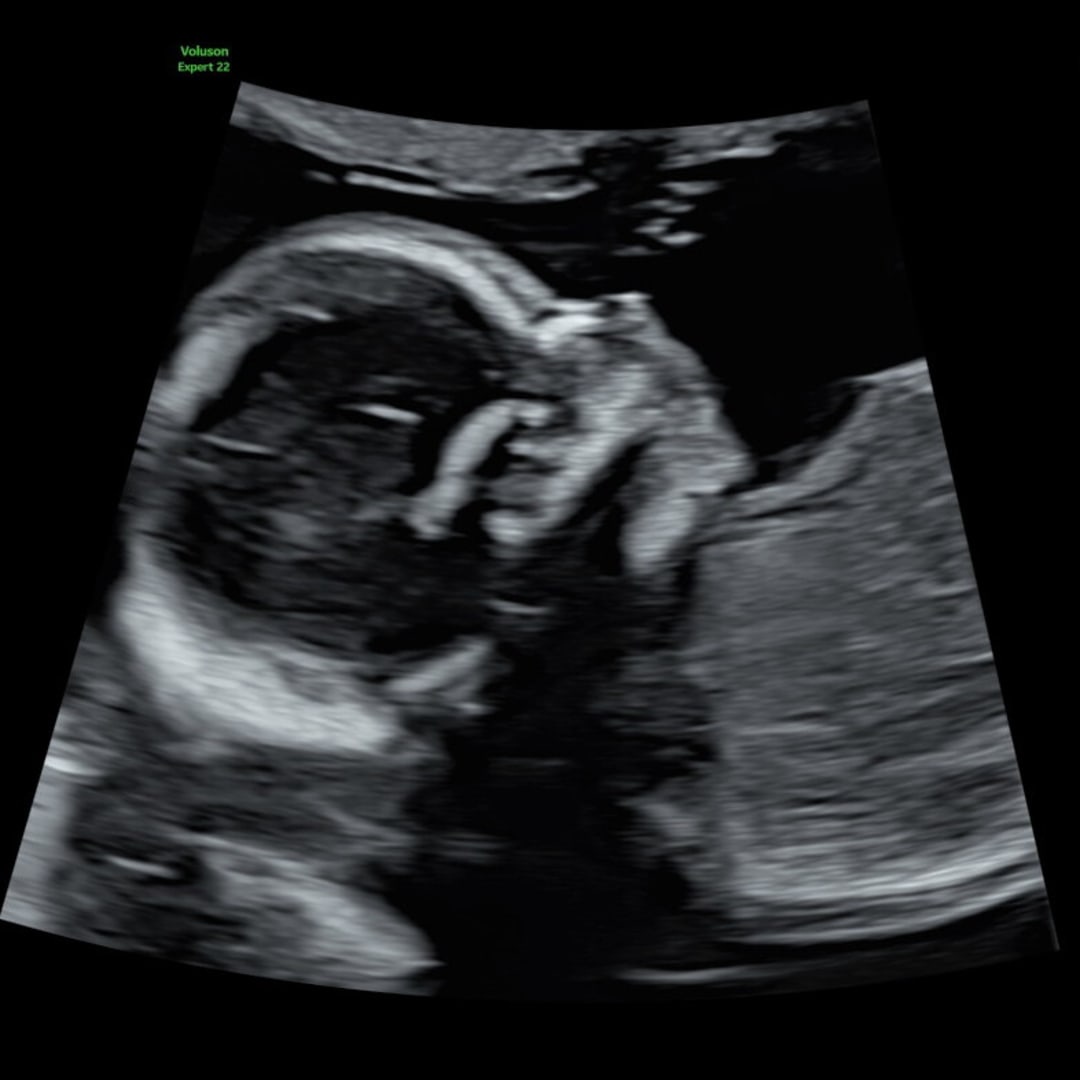 Photo shared by Ashley for their Babylist baby registry.