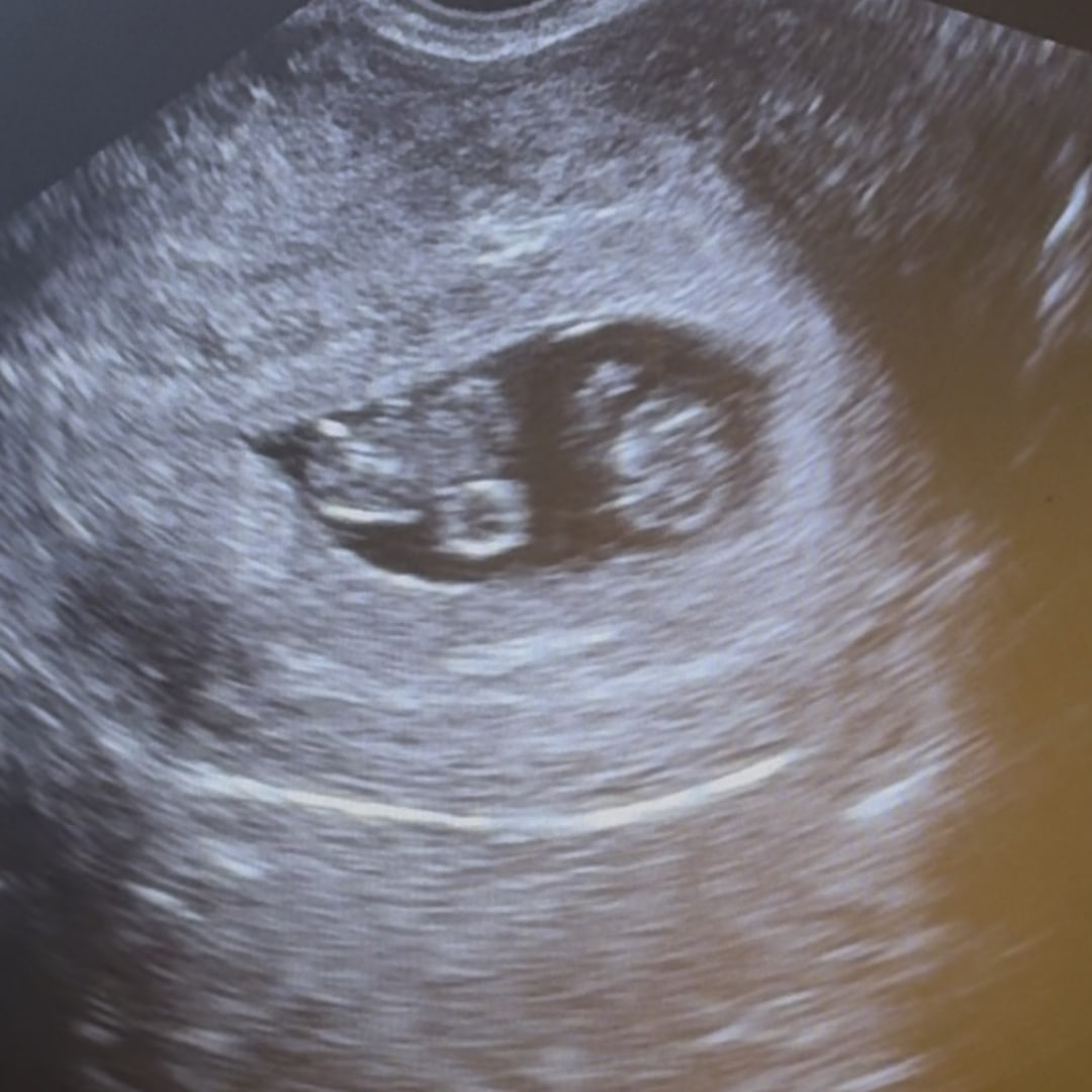 Photo shared by Amanda for their Babylist baby registry.