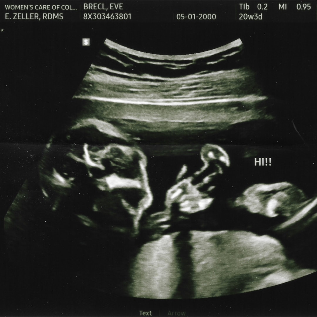 Photo shared by Eve for their Babylist baby registry.