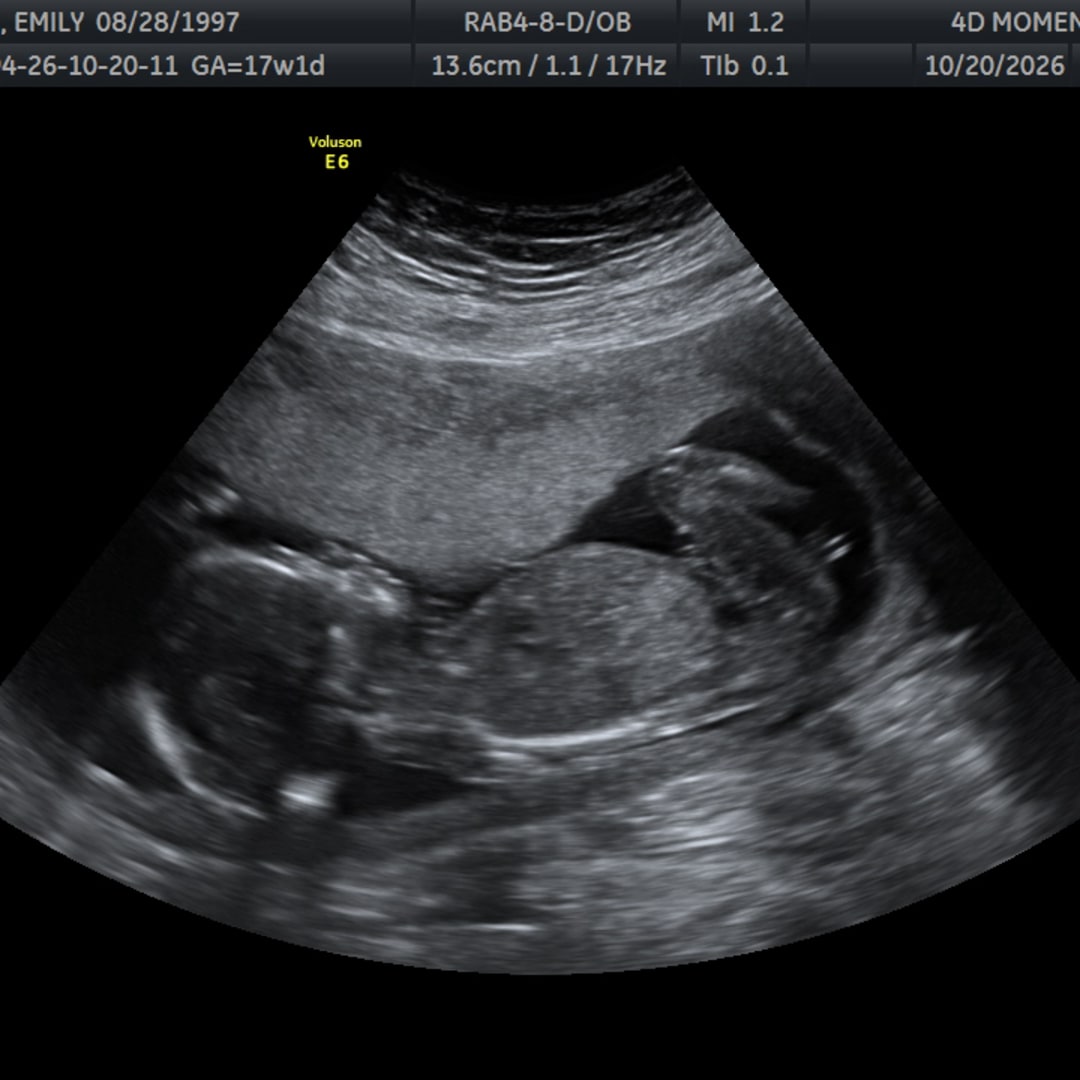 Photo shared by Emily for their Babylist baby registry.