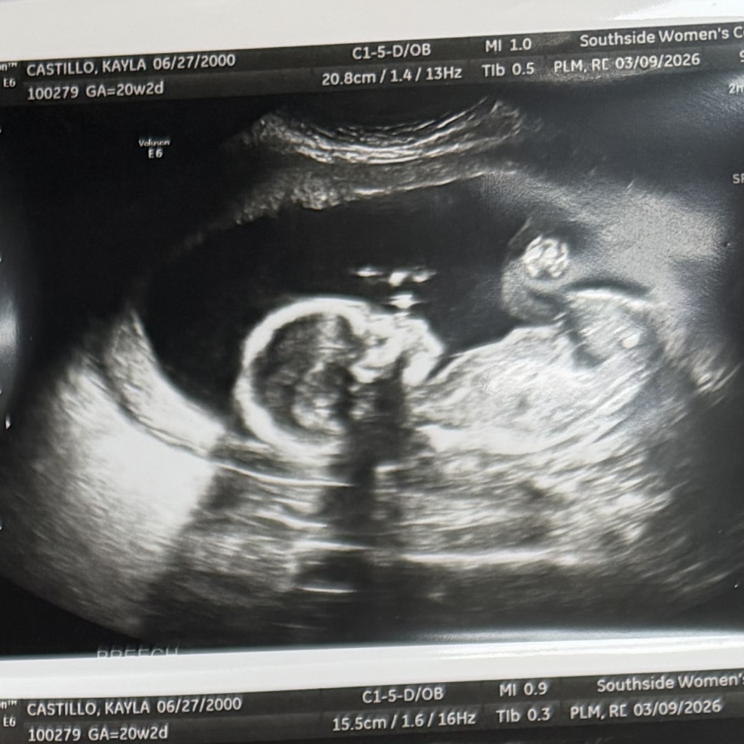 Photo shared by Kayla for their Babylist baby registry.