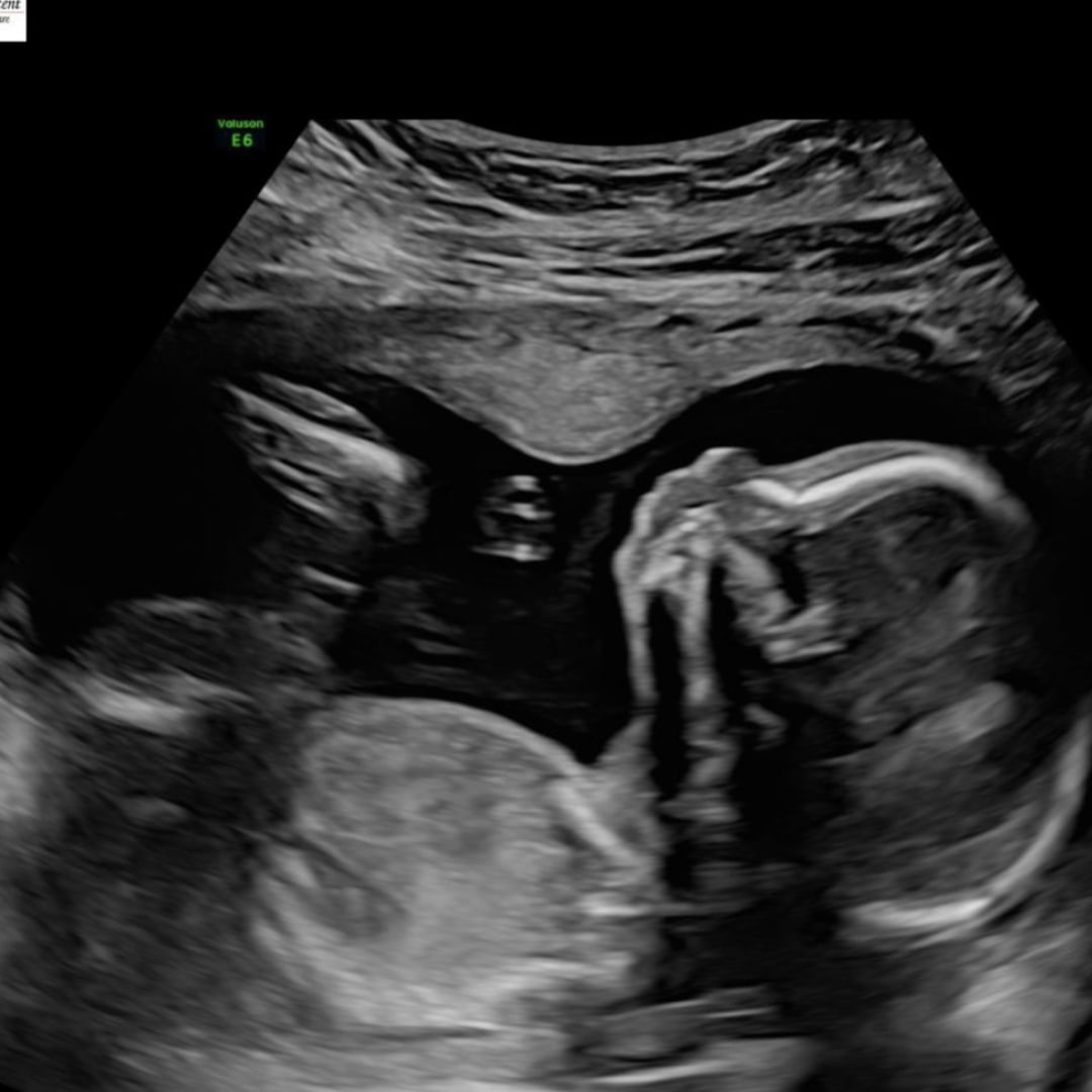 Photo shared by Sydney for their Babylist baby registry.