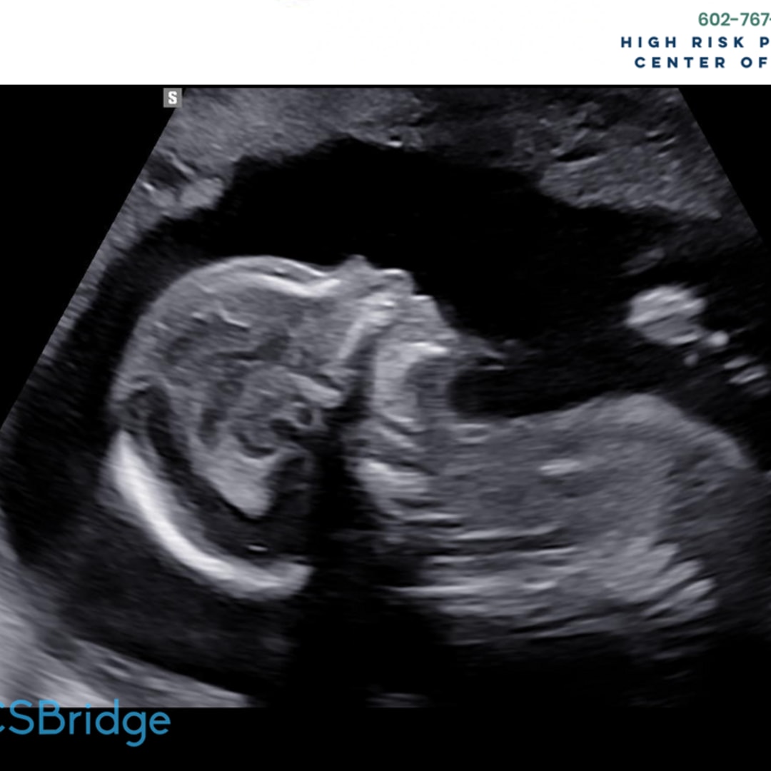 Photo shared by Elaina for their Babylist baby registry.