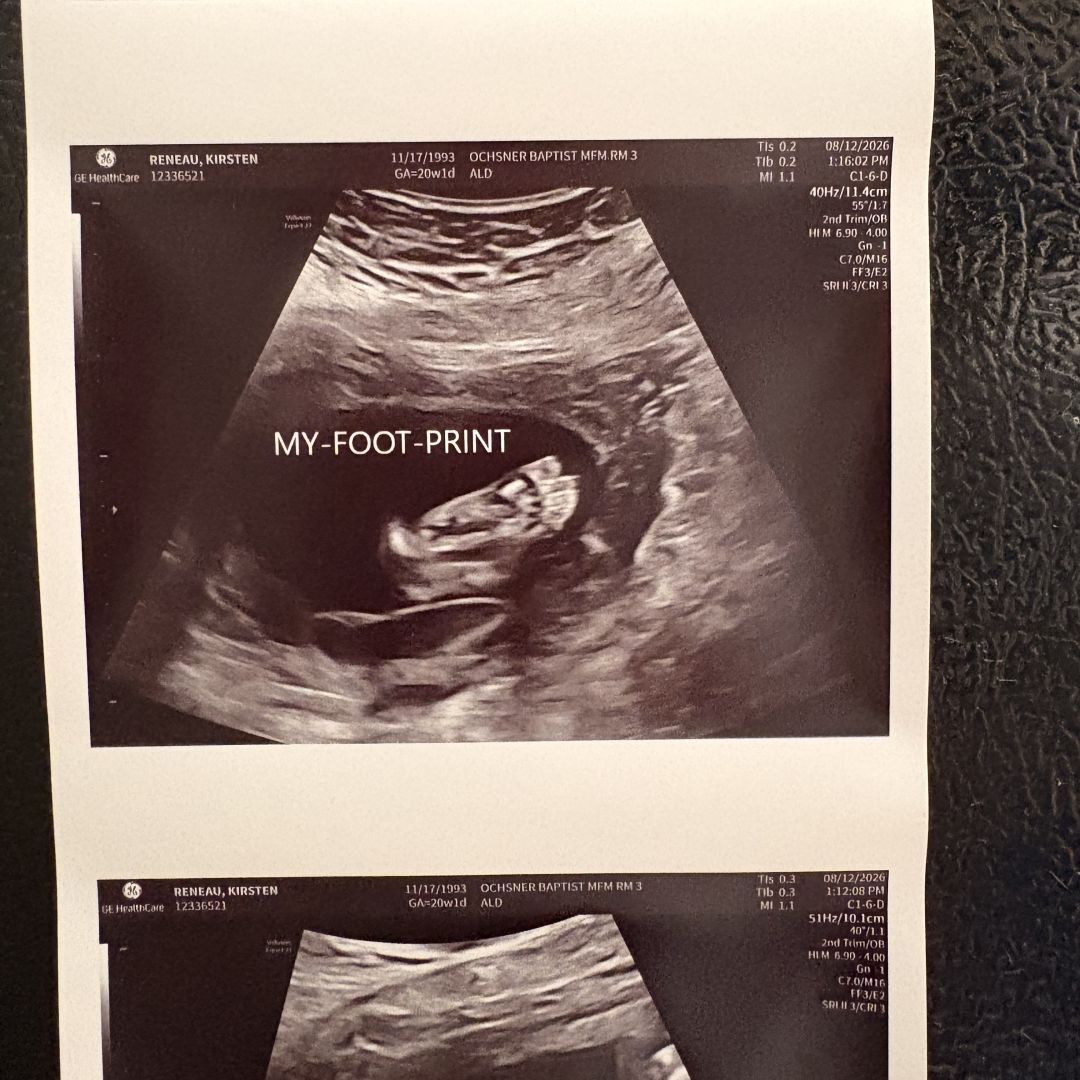 Photo shared by Kirsten for their Babylist baby registry.
