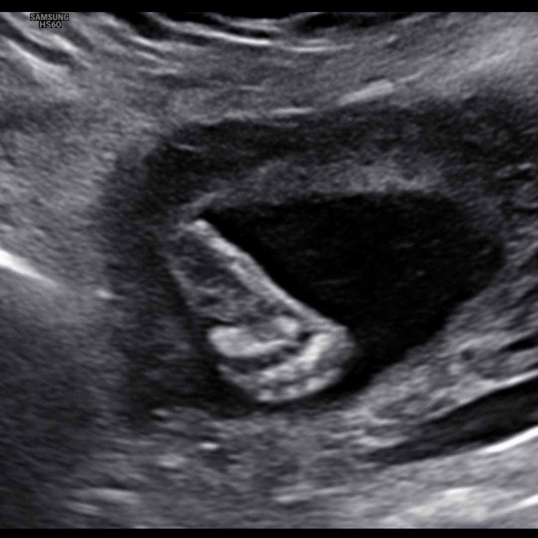 Photo shared by Carson for their Babylist baby registry.