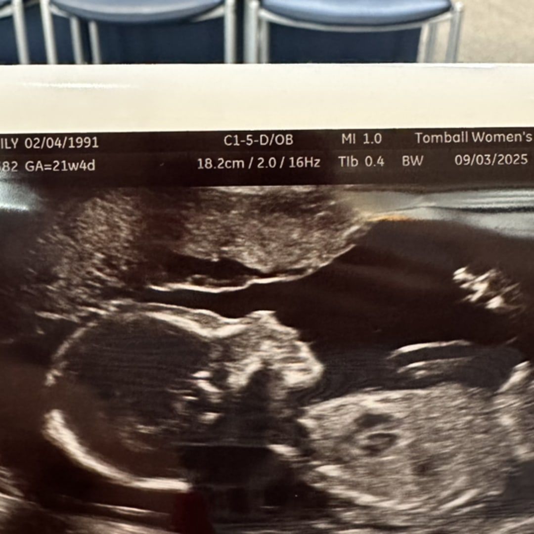 Photo shared by Emily for their Babylist baby registry.