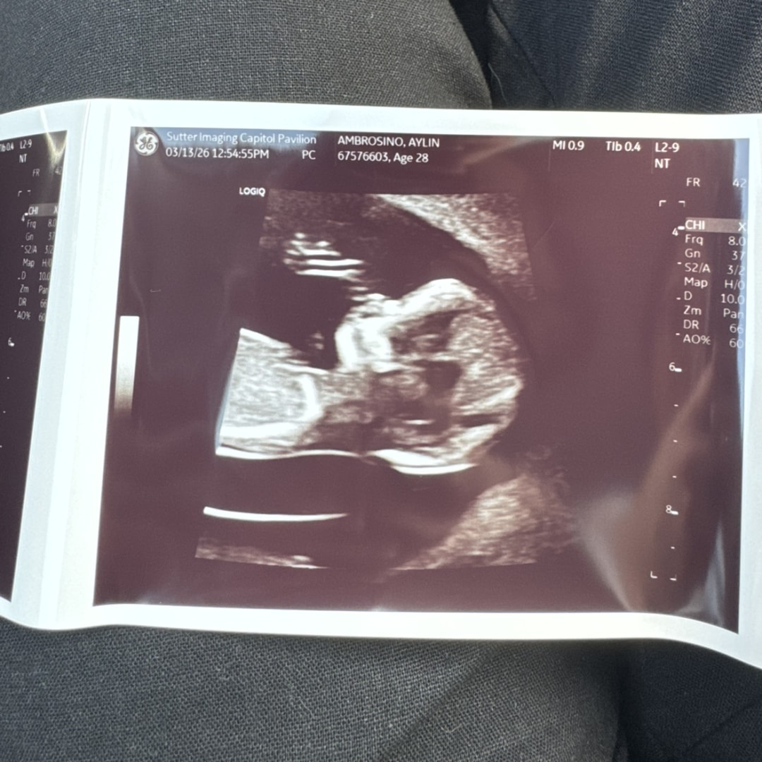 Photo shared by Aylin for their Babylist baby registry.