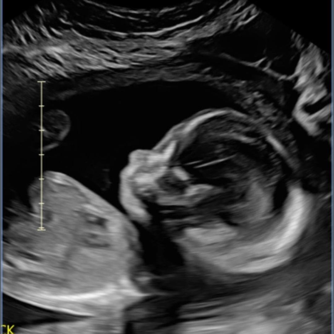 Photo shared by Shannon for their Babylist baby registry.