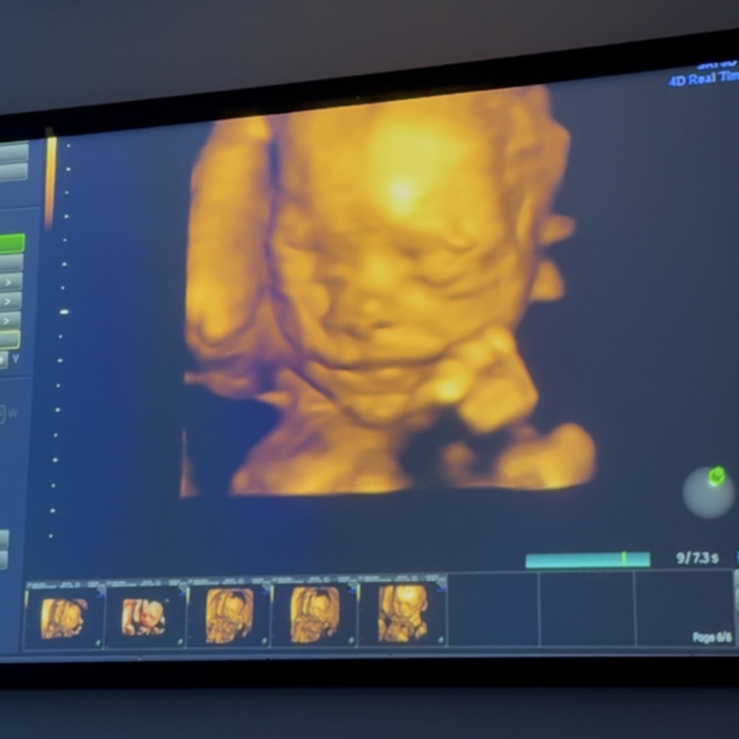 Photo shared by Arianna for their Babylist baby registry.