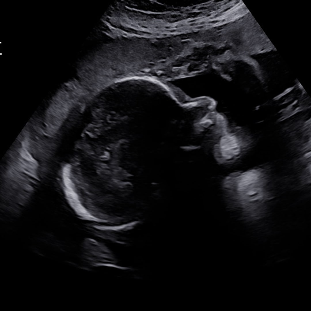 Photo shared by Jacqueline for their Babylist baby registry.