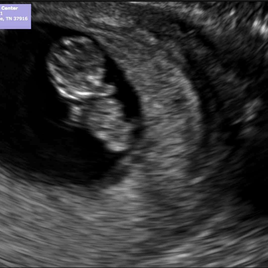 Photo shared by Valeria for their Babylist baby registry.