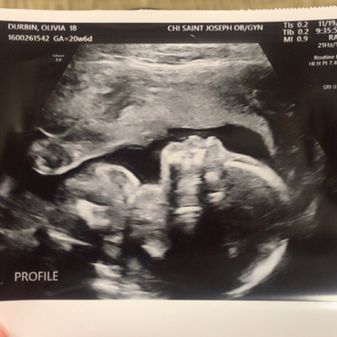 Photo shared by Olivia for their Babylist baby registry.