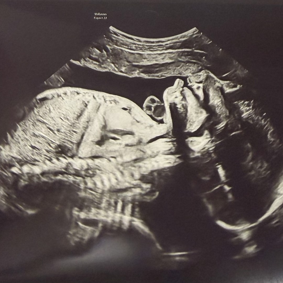 Photo shared by Llialexa for their Babylist baby registry.