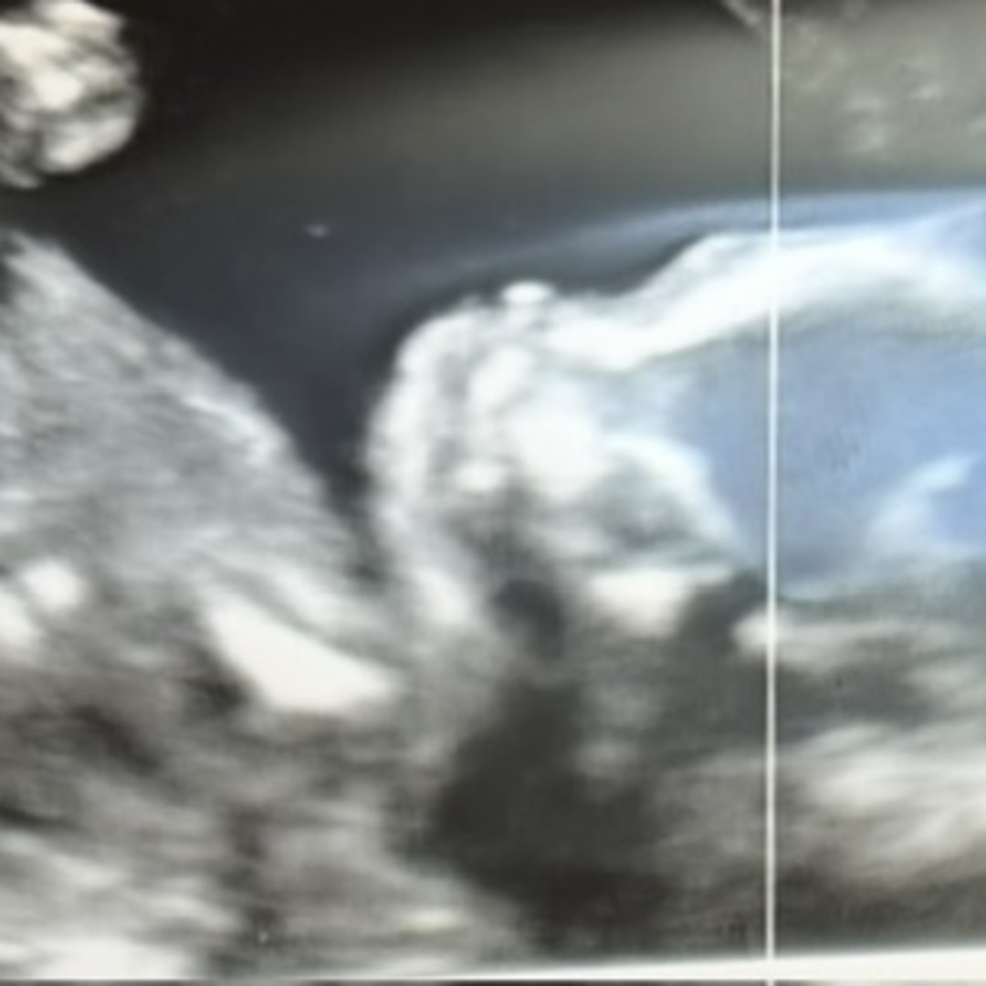 Photo shared by Katelin for their Babylist baby registry.