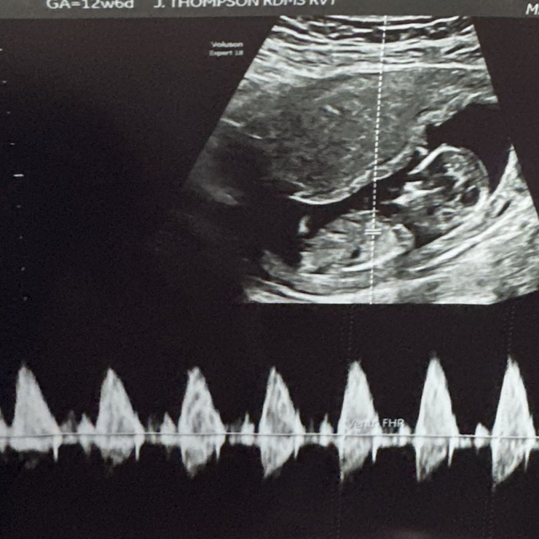 Photo shared by Caitlin for their Babylist baby registry.