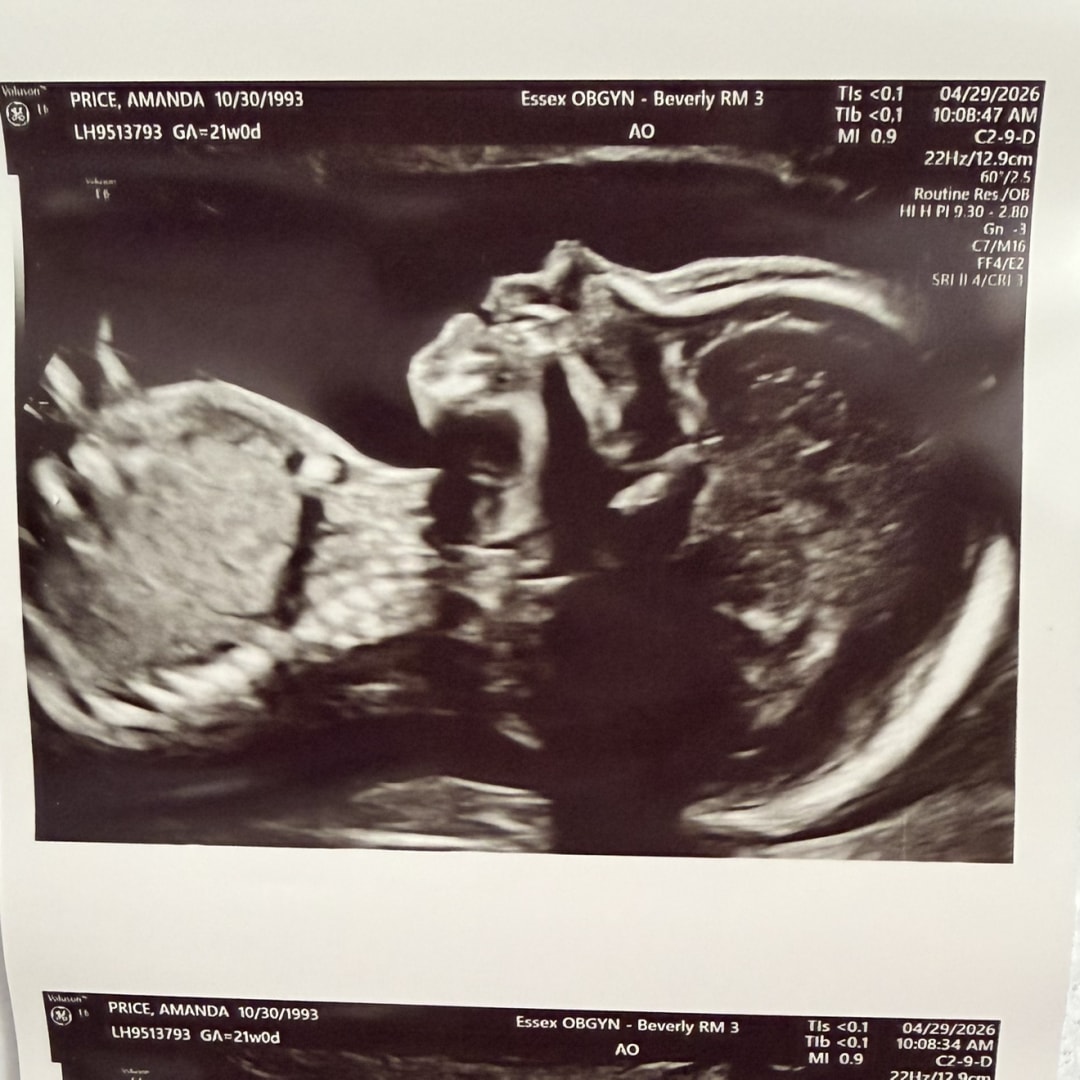Photo shared by Amanda for their Babylist baby registry.