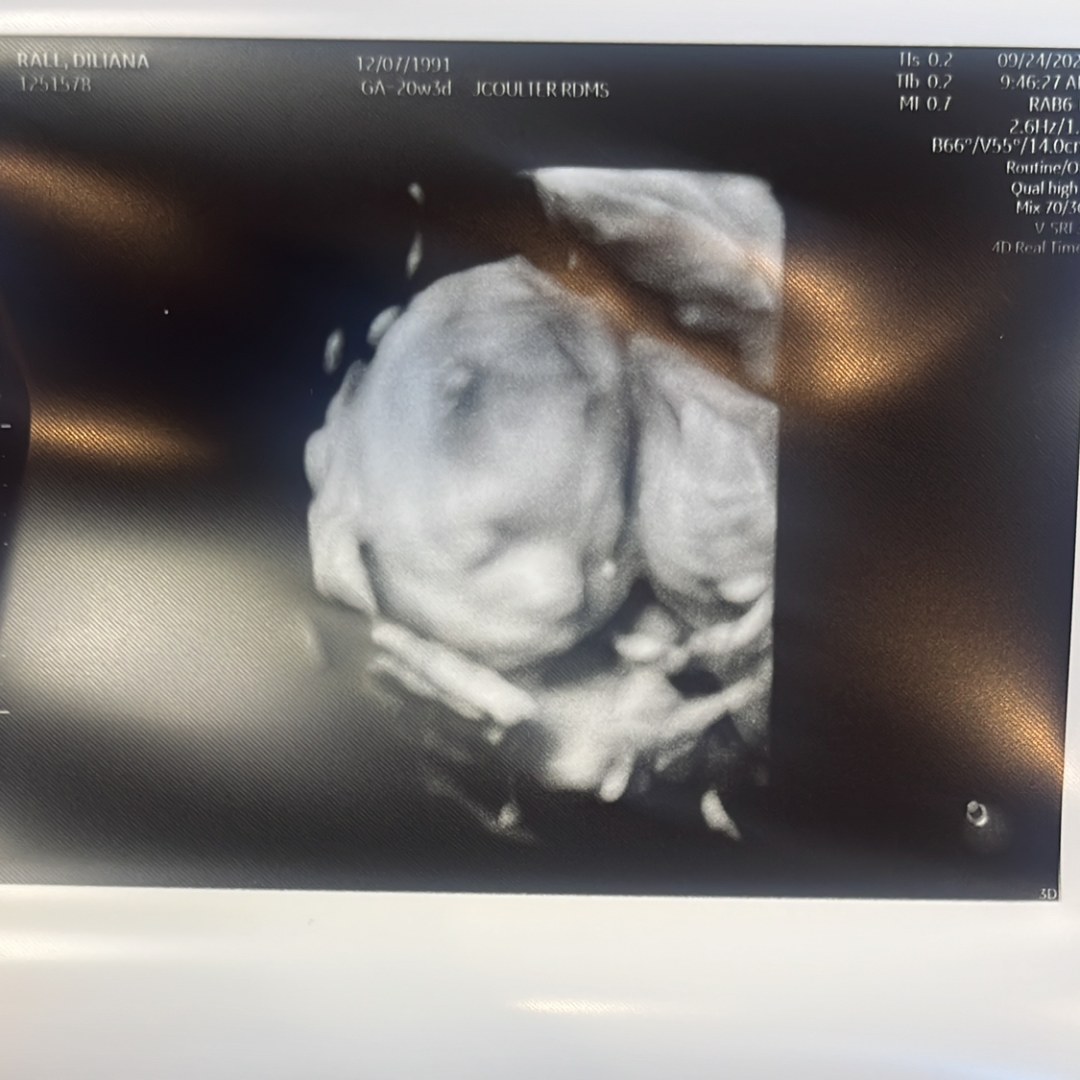 Photo shared by Diliana for their Babylist baby registry.