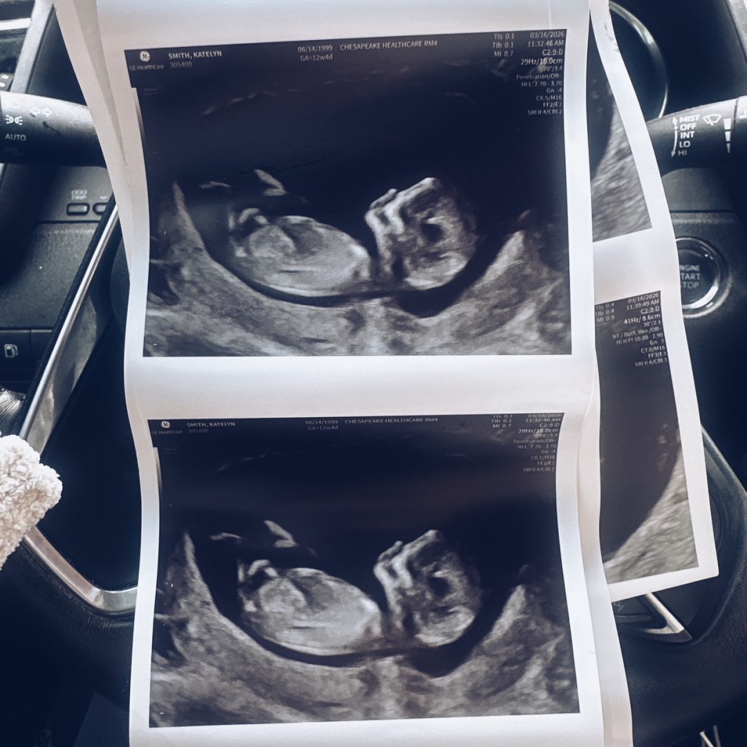 Photo shared by Katie for their Babylist baby registry.
