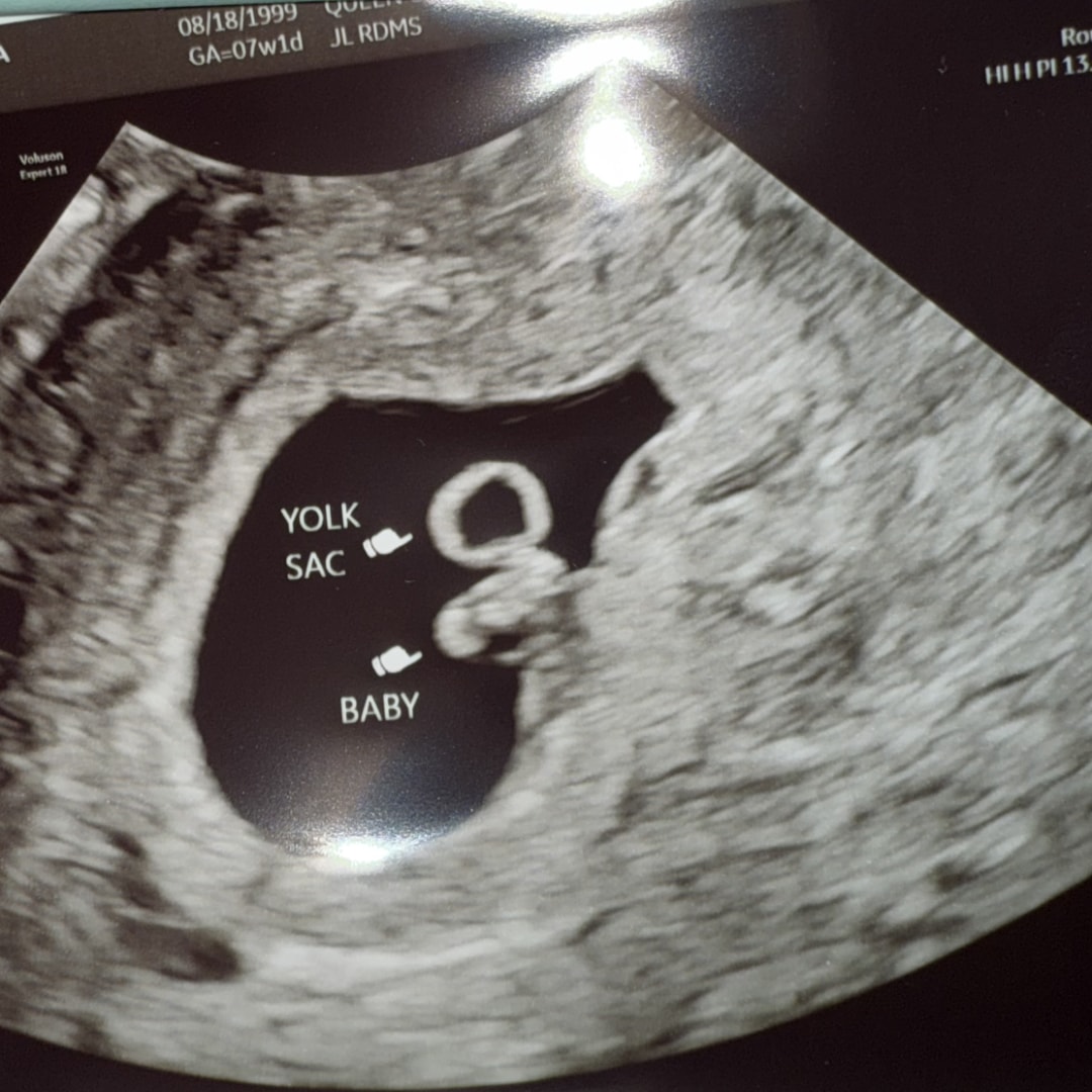 Photo shared by Cassie for their Babylist baby registry.