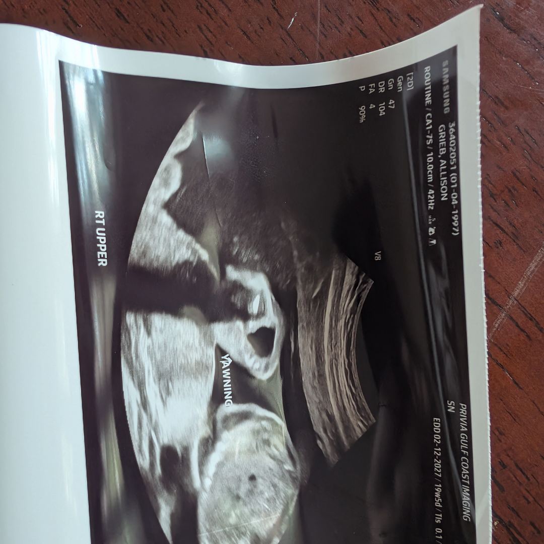 Photo shared by Allie for their Babylist baby registry.