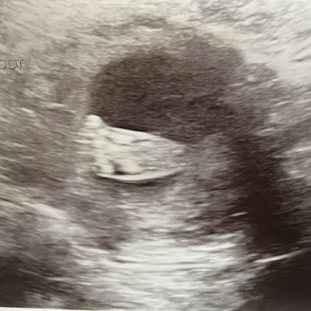 Photo shared by Jamie for their Babylist baby registry.