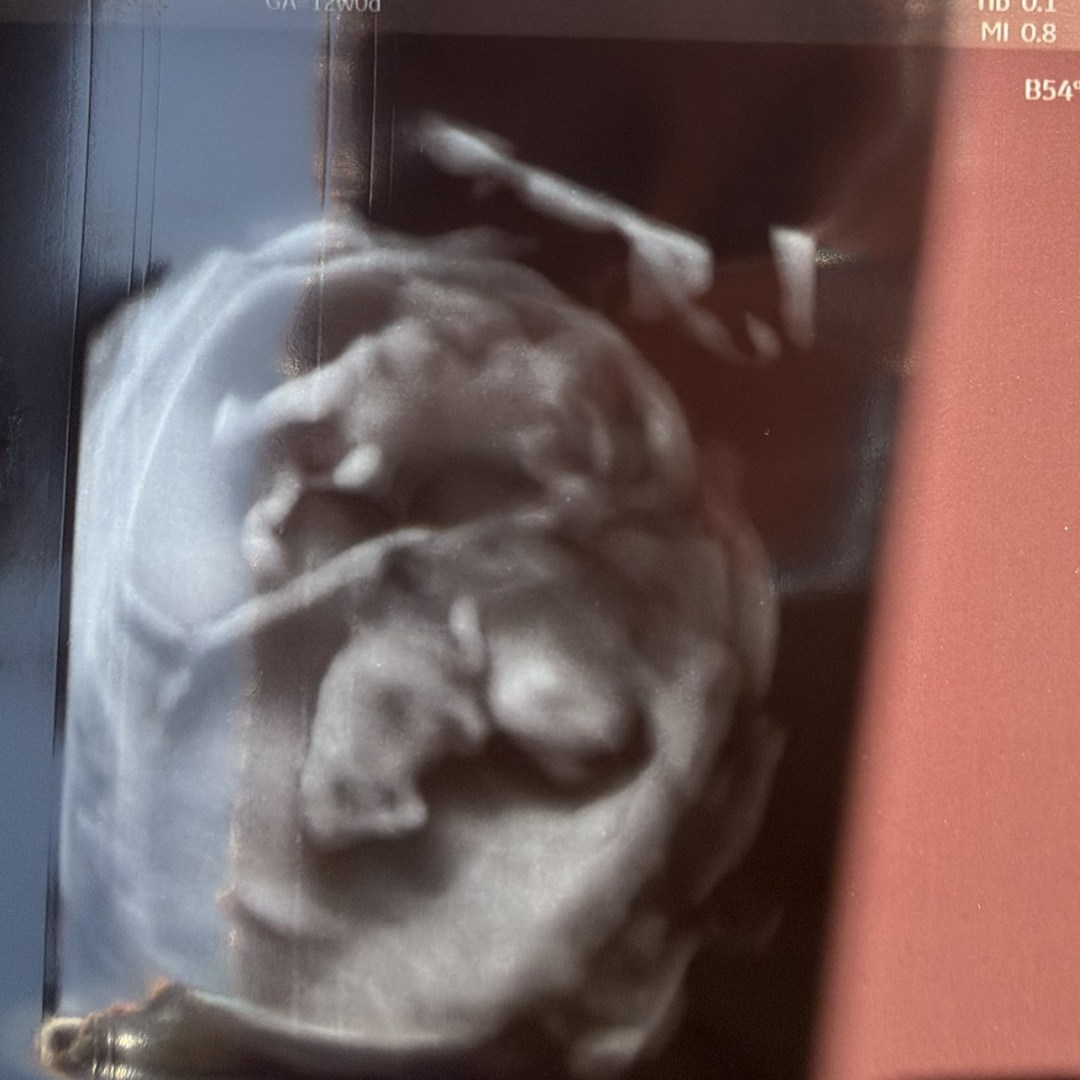 Photo shared by Ganya for their Babylist baby registry.