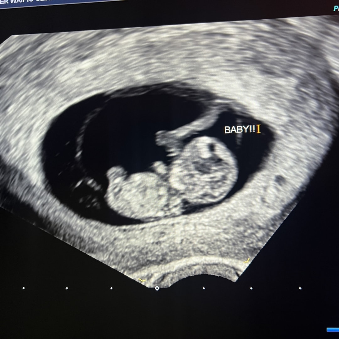 Photo shared by Kristel for their Babylist baby registry.