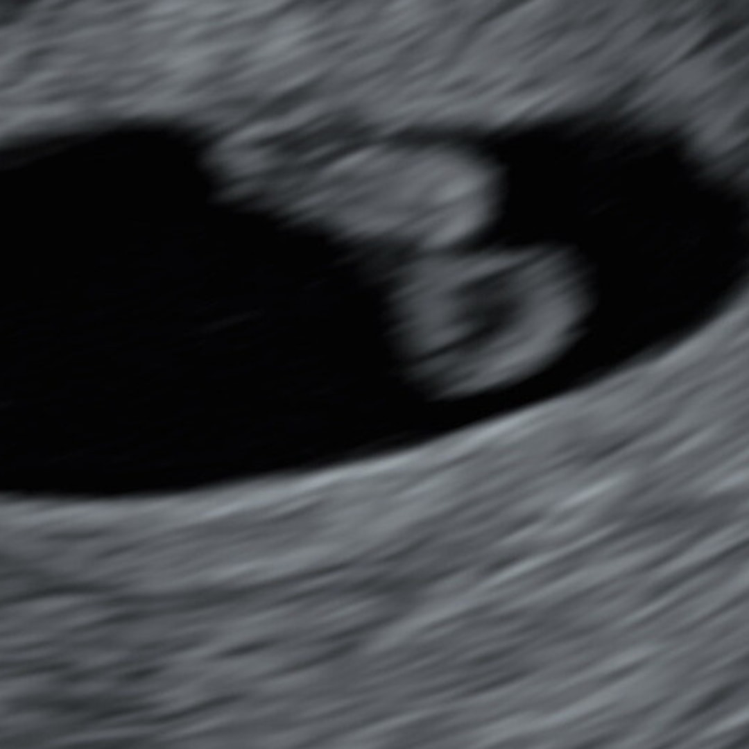 Photo shared by Alibelle for their Babylist baby registry.