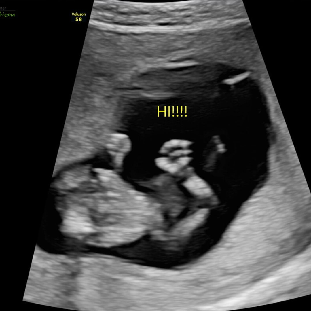 Photo shared by Hannah for their Babylist baby registry.