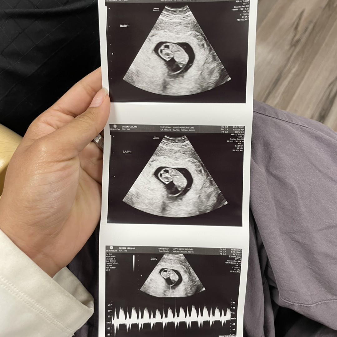 Photo shared by Leilani for their Babylist baby registry.