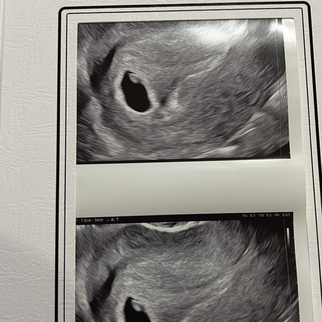 Photo shared by Shabria for their Babylist baby registry.