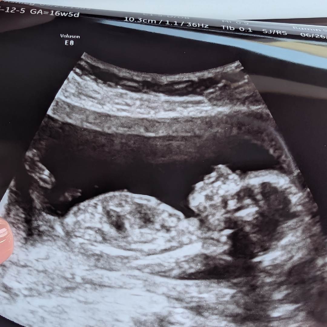 Photo shared by Asher for their Babylist baby registry.