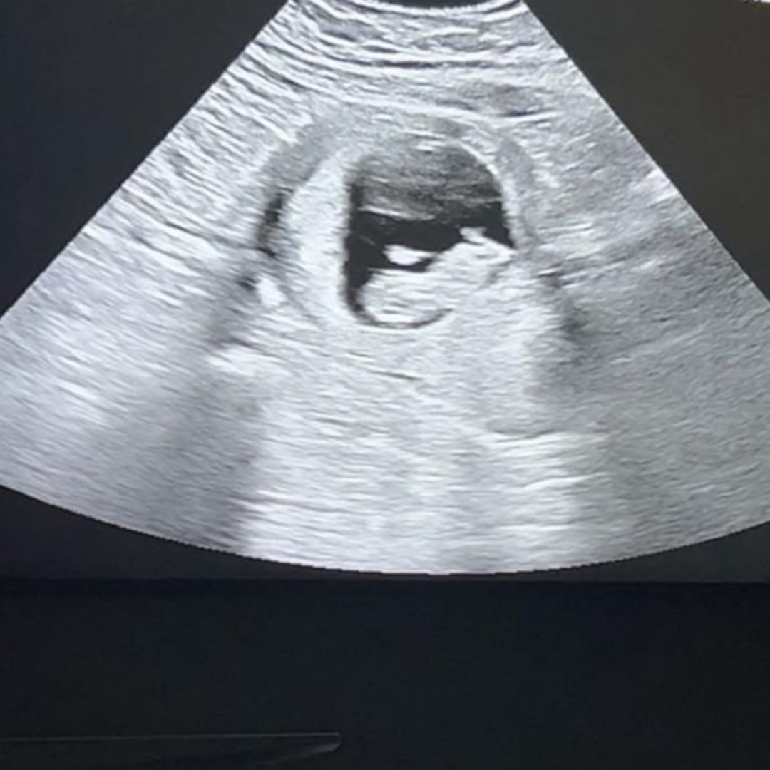 Photo shared by Hannah for their Babylist baby registry.