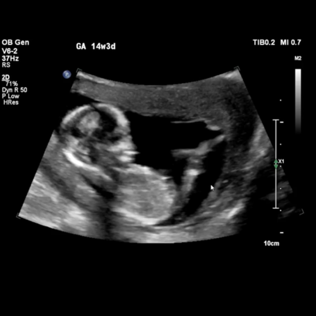 Photo shared by Kristina for their Babylist baby registry.