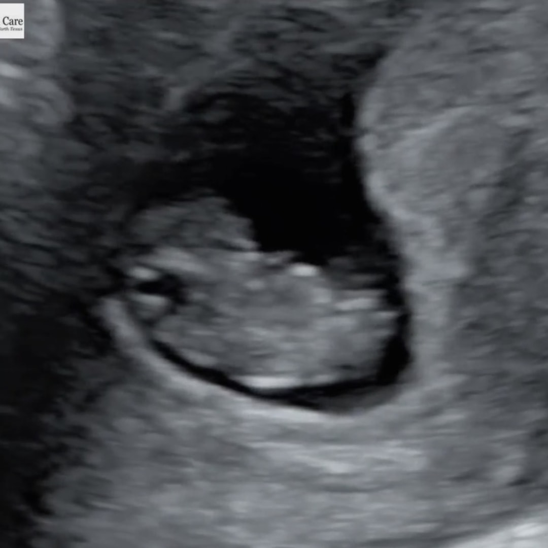 Photo shared by Caylen for their Babylist baby registry.