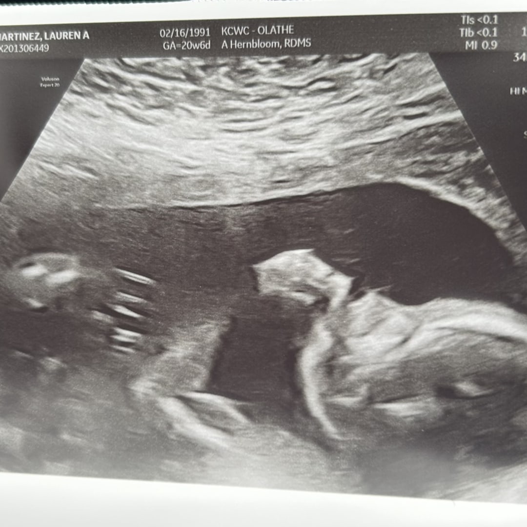 Photo shared by Lauren for their Babylist baby registry.