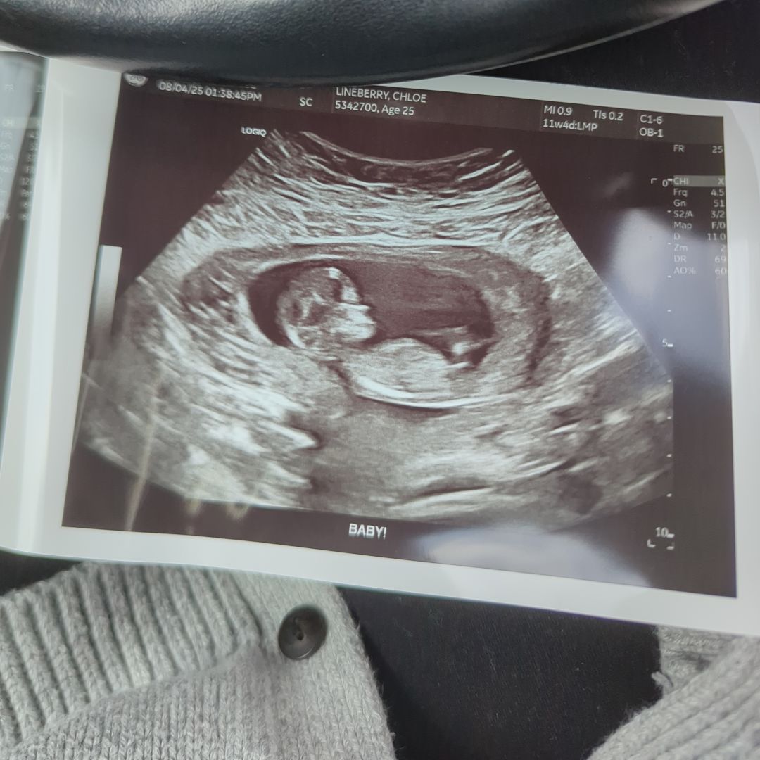 Photo shared by Chloe for their Babylist baby registry.