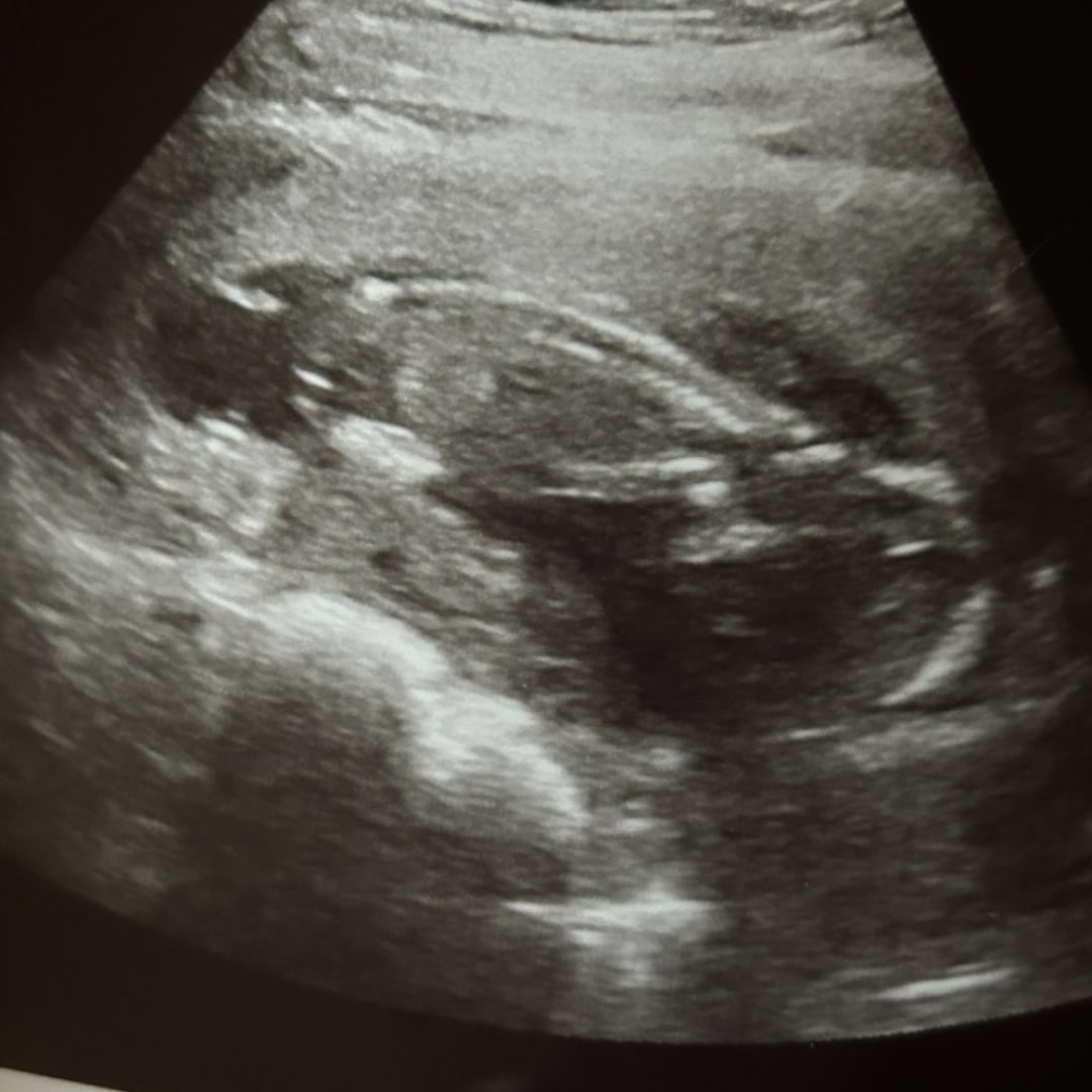 Photo shared by Sam “Arty” for their Babylist baby registry.