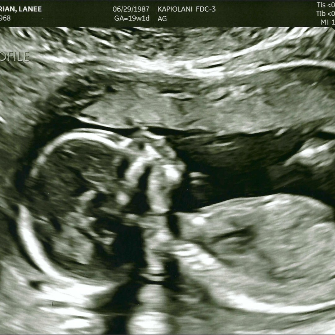 Photo shared by Lanee for their Babylist baby registry.