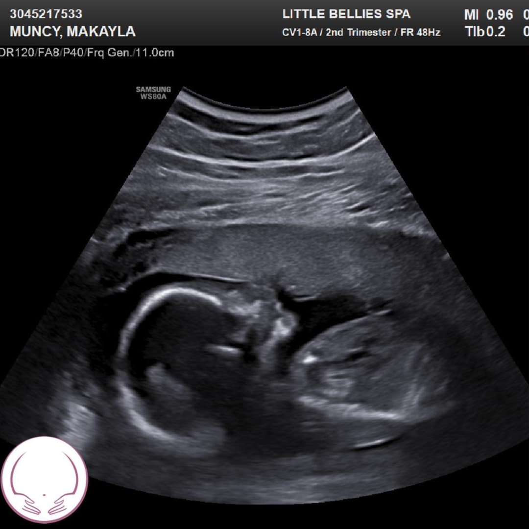 Photo shared by Makayla for their Babylist baby registry.