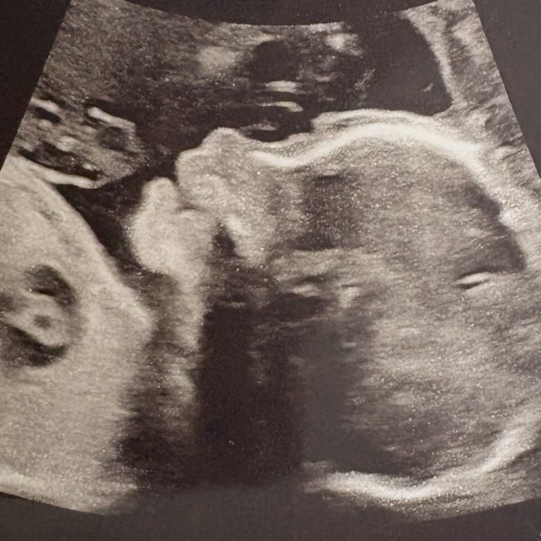 Photo shared by Brittany for their Babylist baby registry.