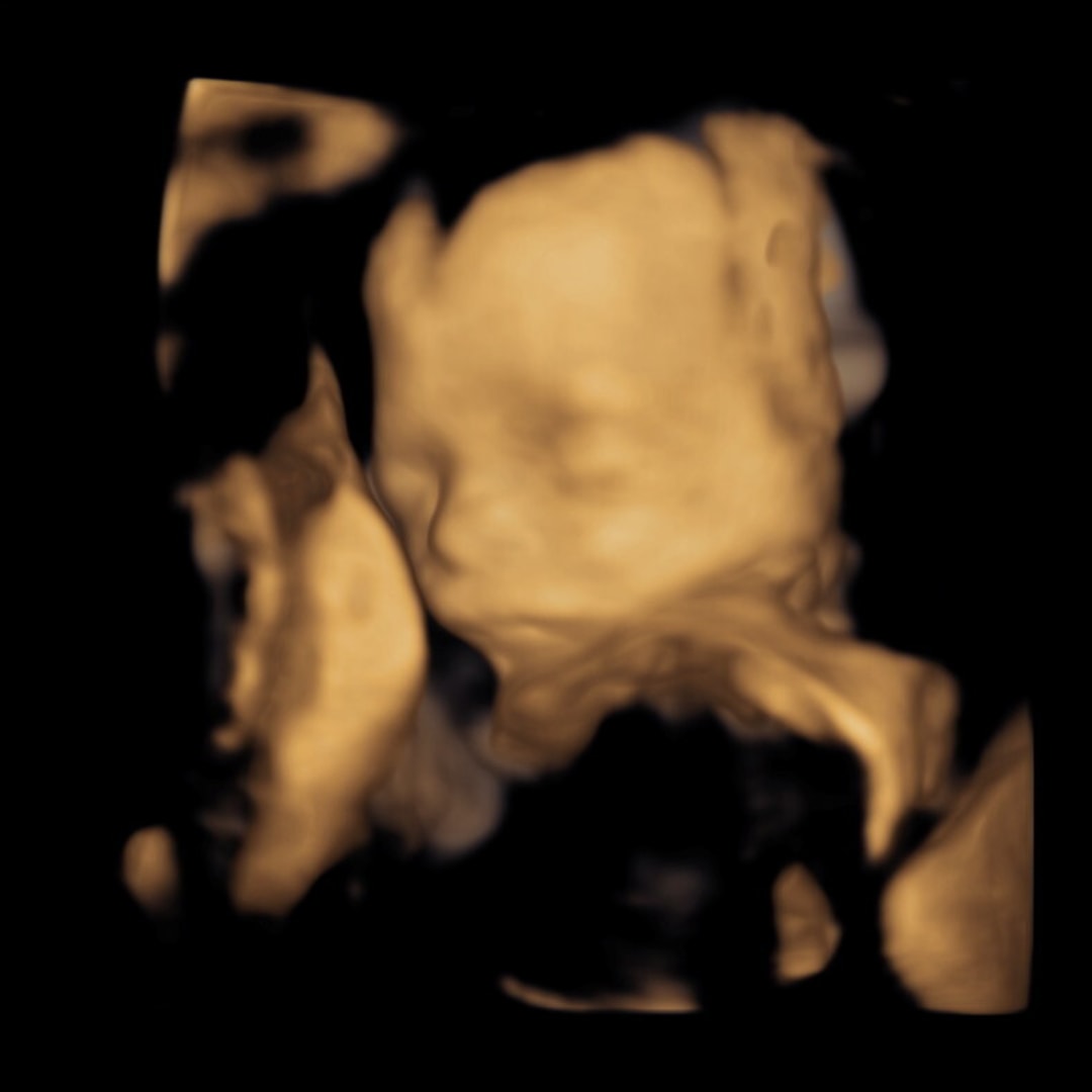 Photo shared by Kylie for their Babylist baby registry.