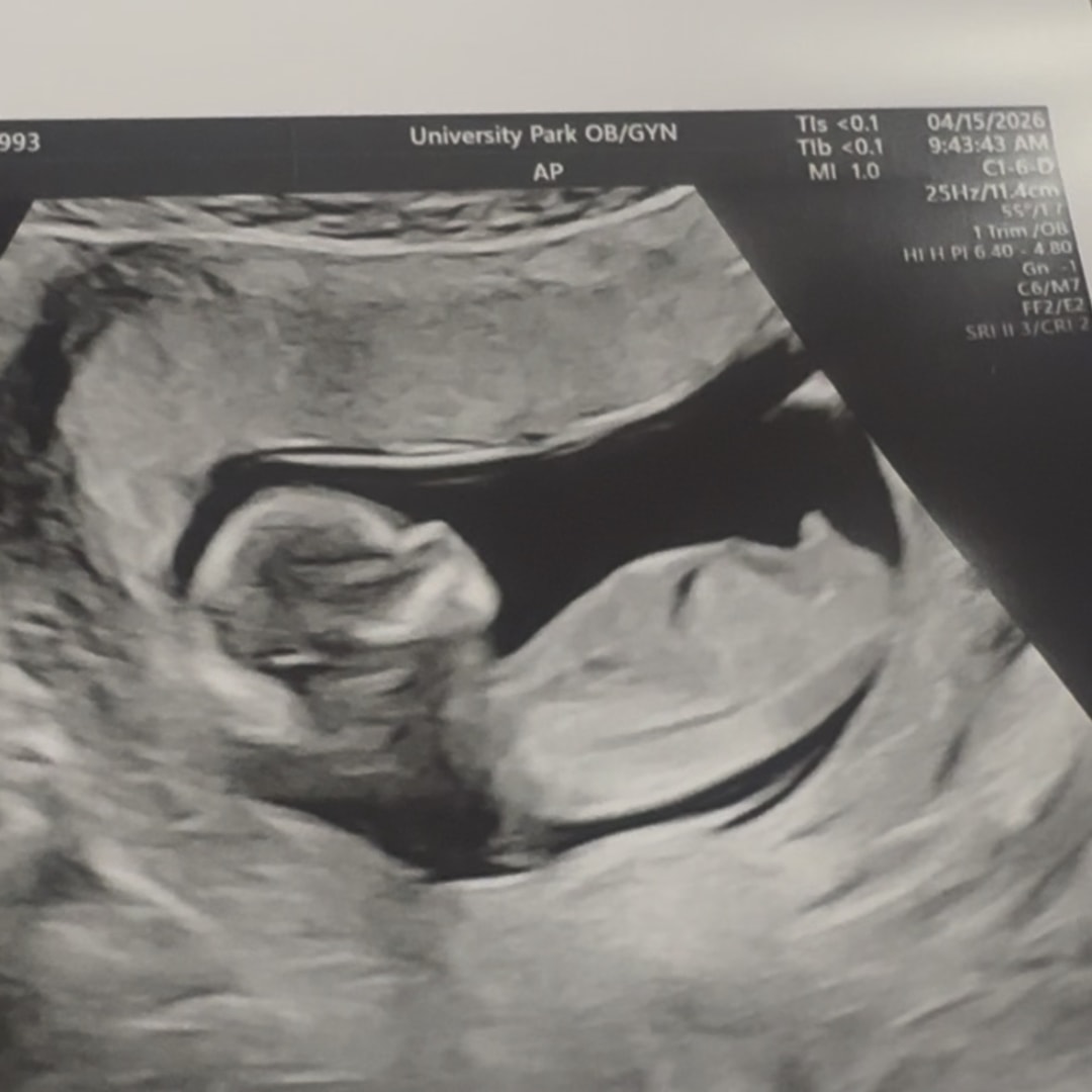 Photo shared by Sarah for their Babylist baby registry.