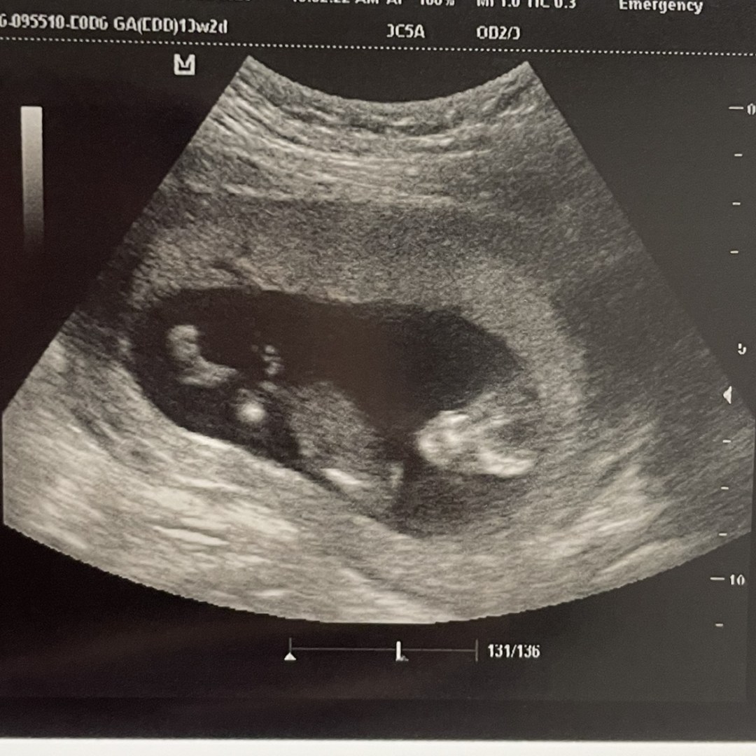 Photo shared by Xena for their Babylist baby registry.