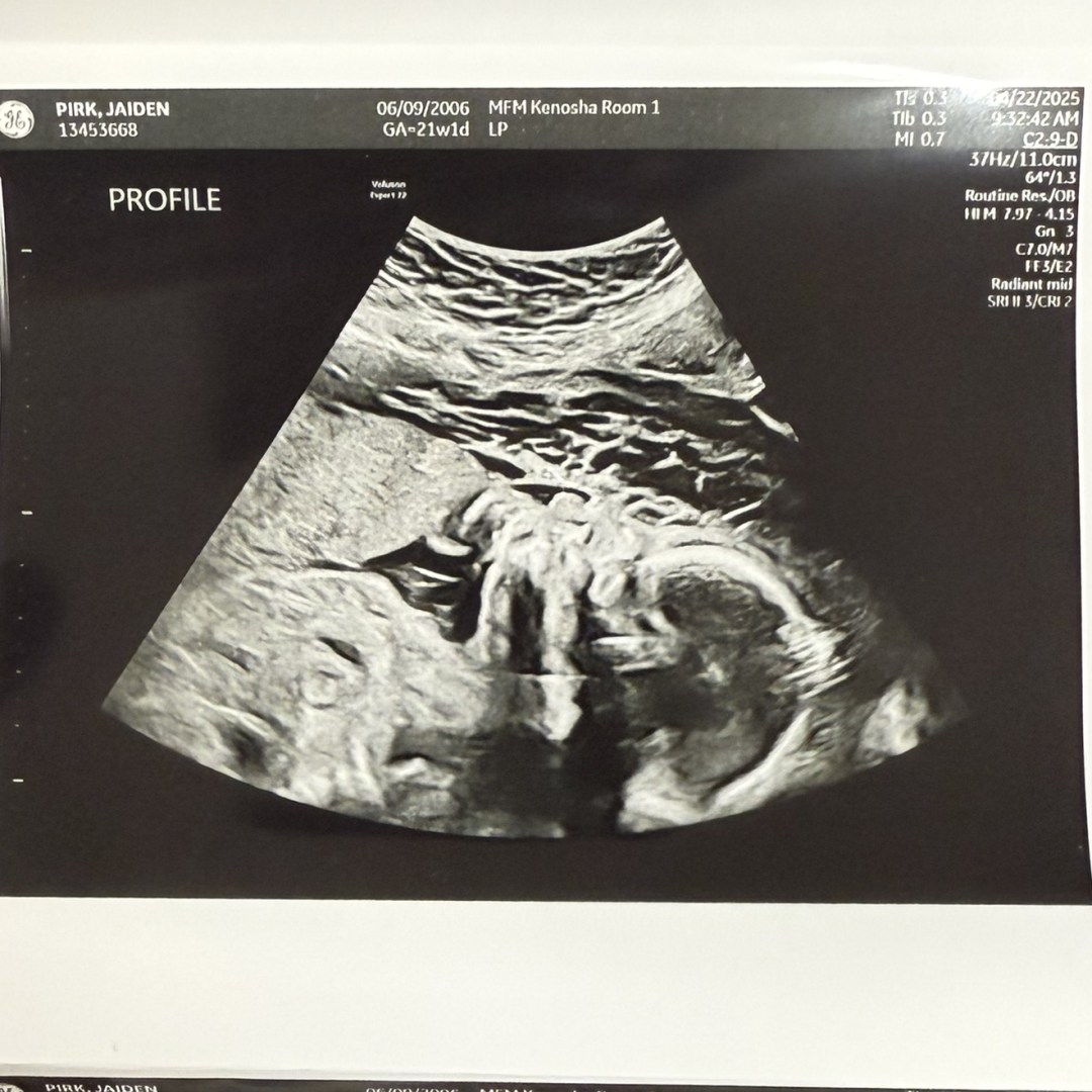 Photo shared by Jaiden for their Babylist baby registry.