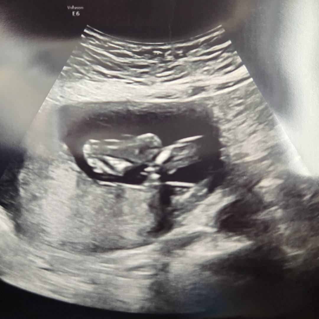 Photo shared by Becca for their Babylist baby registry.
