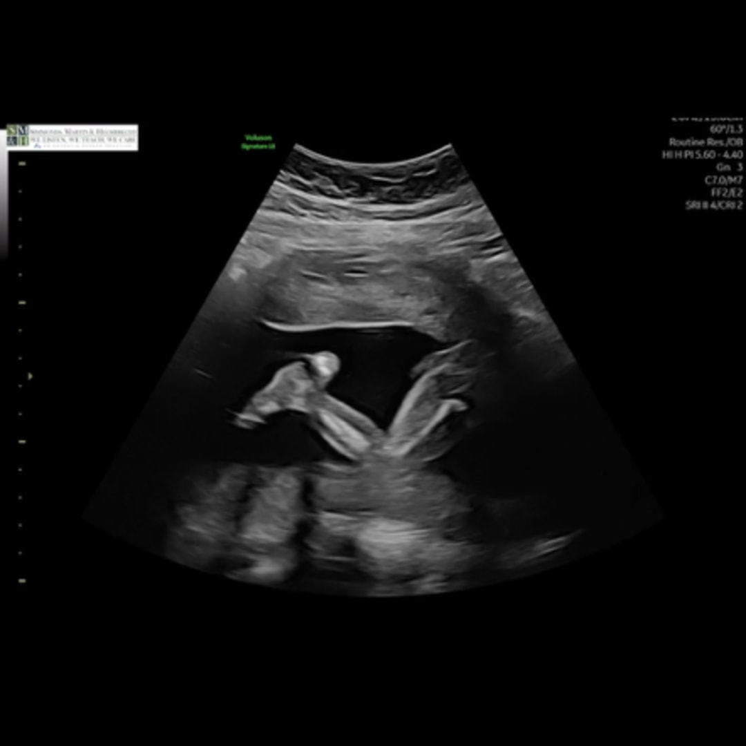 Photo shared by Andrea for their Babylist baby registry.