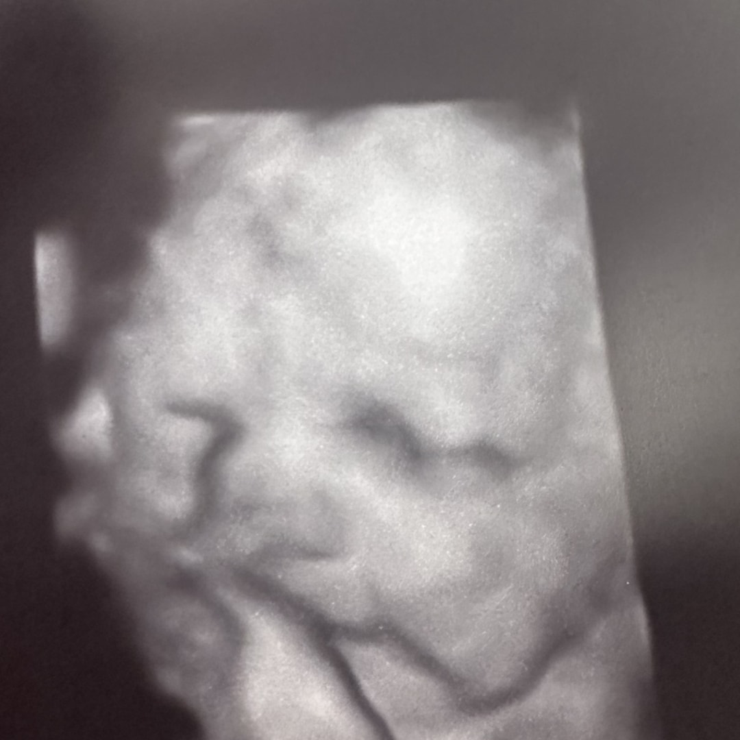 Photo shared by Cynthia for their Babylist baby registry.