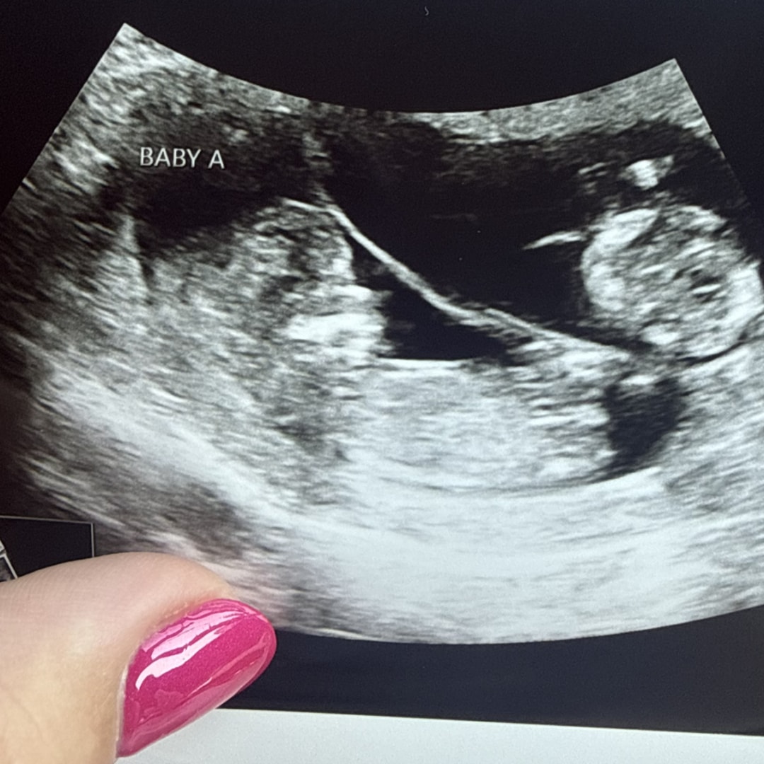 Photo shared by Gia for their Babylist baby registry.